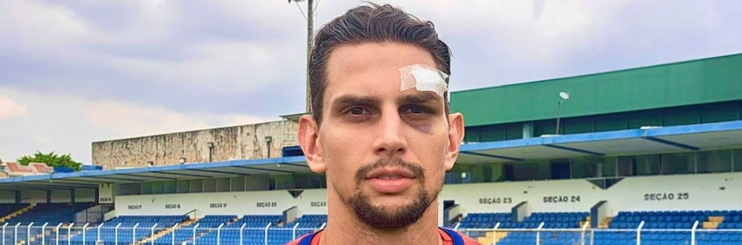 imagem da materia: Goleiro do São Caetano está se recuperando após machucar o rosto