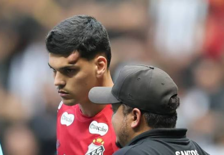 imagem da materia: Brazão deve jogar contra o São Paulo? Confira